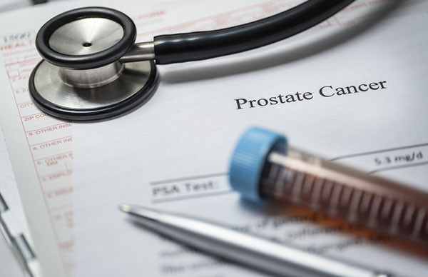 Read more about the article Promising therapy if PSA rises after prostate cancer surgery
